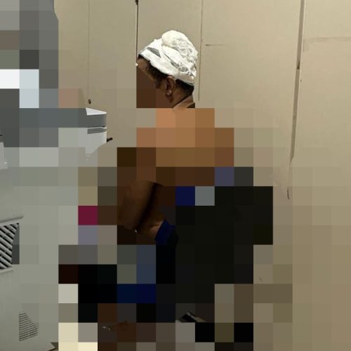 Riachão do Jacuípe: Homem com deficiência visual recebe vários golpes de porrete após provocar sobrinho com som alto e chamar de ‘maconheiro’