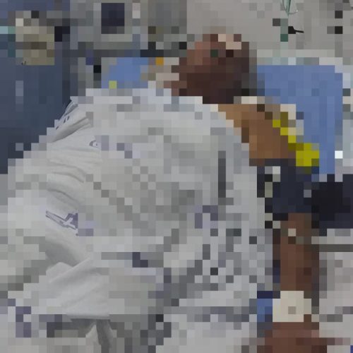 Coité: Idosa de 76 anos é transferida para Feira de Santana após ser atropelada; adolescente supostamente empinava moto no momento do acidente