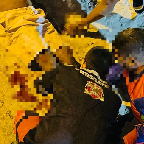 Colisão entre motos deixa homem com fratura exposta no bairro da Quadra em Conceição do Coité