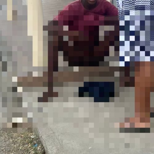 Adolescente é mordido no pênis por pitbull ao tentar pular muro em Santaluz; família contesta