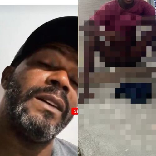 Família questiona versão de mordida de pitbull e levanta suspeita de crime contra adolescente em Santaluz